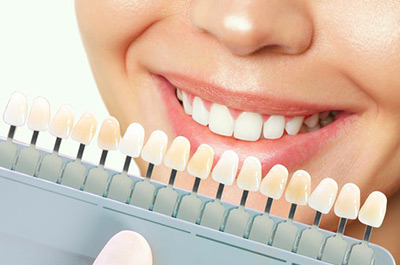 Фотоотбеливание magic smile цена