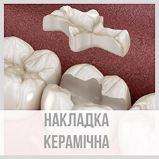 Накладка керамічна