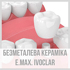 Безметалева кераміка E.max. Ivoclar (пресована)