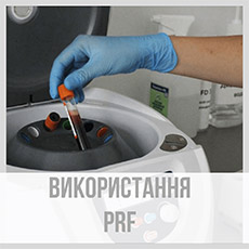 Використання PRF