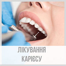 Лікування карієсу